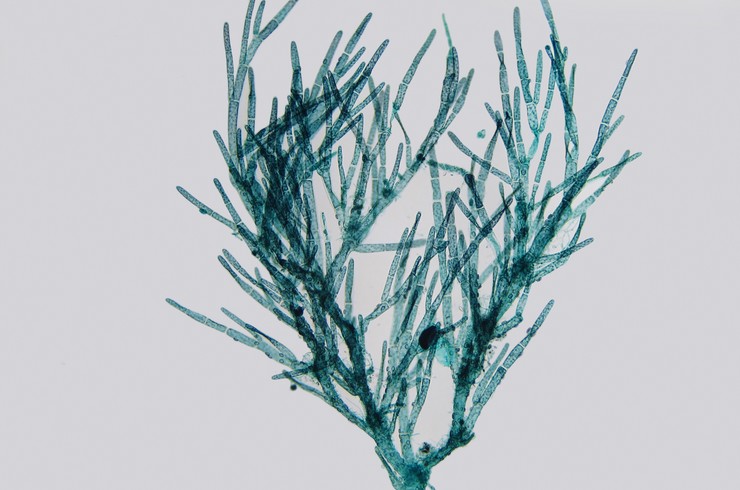 Водоросль кладофора (Cladophora sp.) под микроскопом
